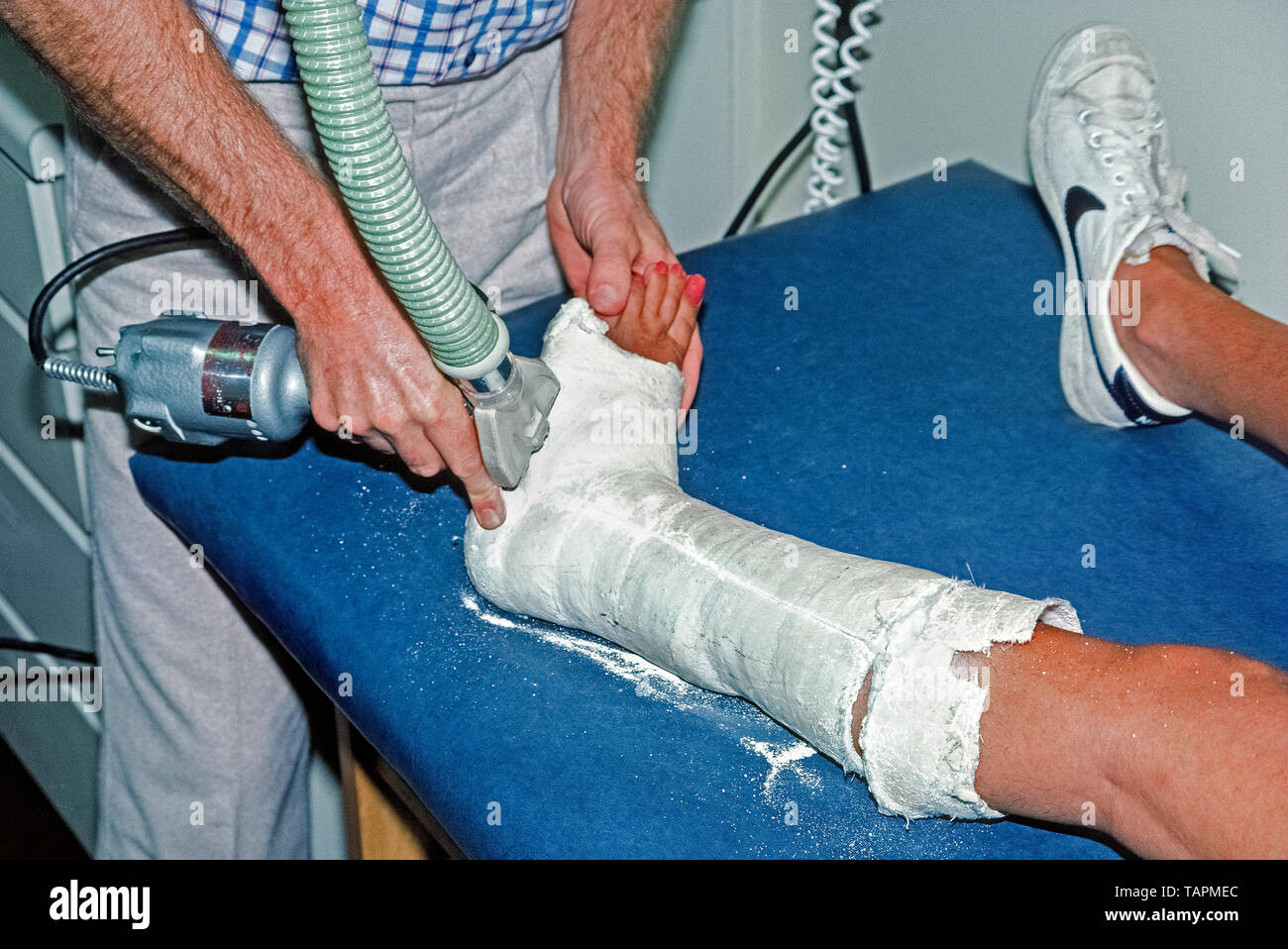A special electric-powered saw is used by an orthopedic physician to make perforations in the plaster cast that supported the broken ankle of a Caucasian woman while the fractured bone in her left leg was healing. The blade of this oscillating cast saw vibrates instead of spinning, which prevents it from cutting the skin. After cuts have been made to the cast, it is pried apart so that the plaster and inside cotton lining can easily be removed from the injured appendage. The oscillating saw was patented for medical use in 1945 by an American orthopaedic surgeon, Dr. Homer Stryker. Stock Photo