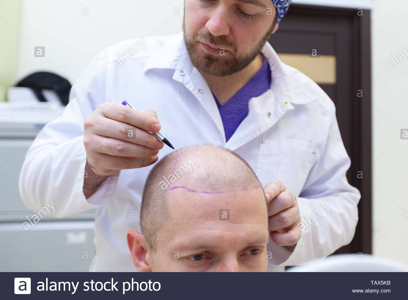 which doctor is for hair loss