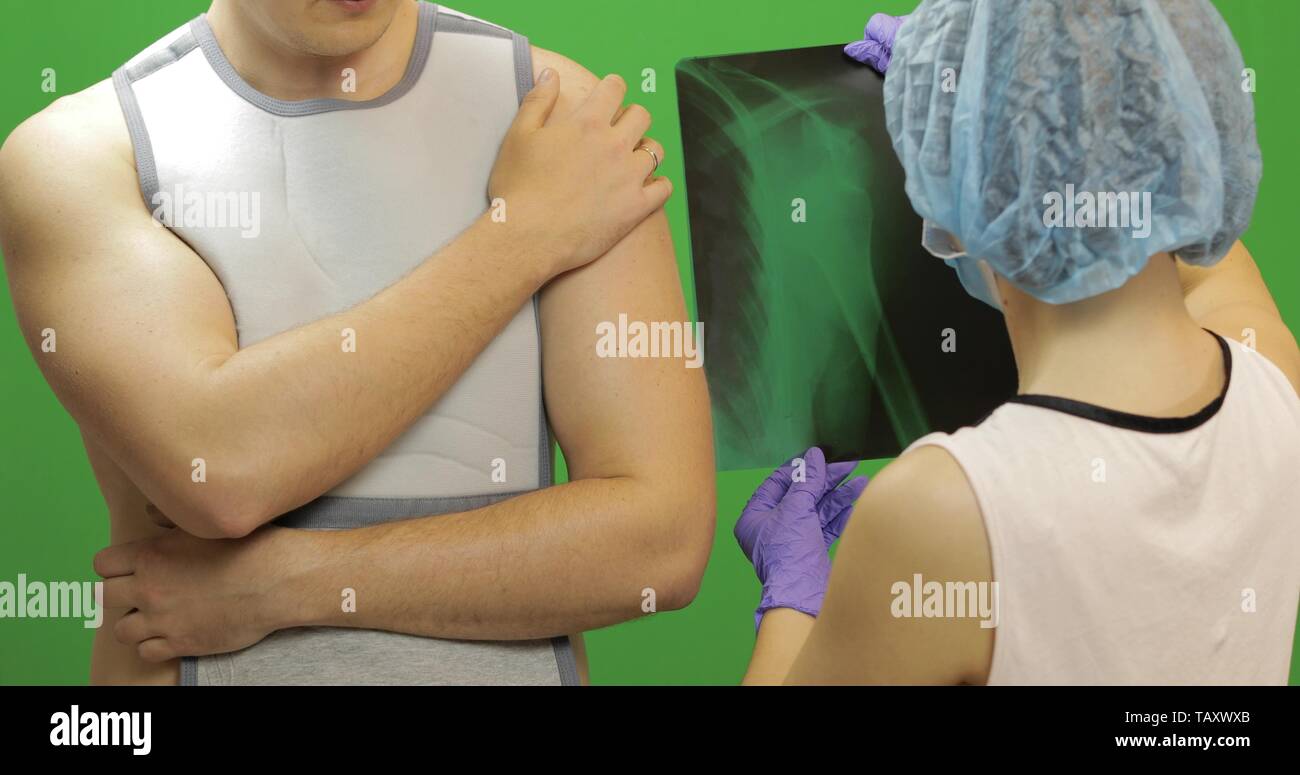 Man with shoulder injury. Wearing a bandage for fixing of an elbow joint and a humeral belt. Dislocations of arm of the forearm, shoulder. Broken bones. Nurse examines x-ray, gives advice to patient Stock Photo