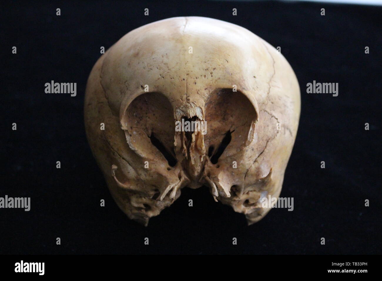 'Starchild' Skull, Peru Stock Photo