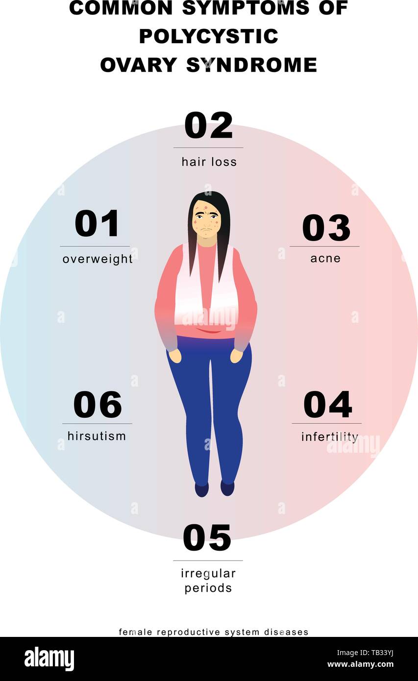 PCOS Symptoms infographic. Vector illustration Stock Vector