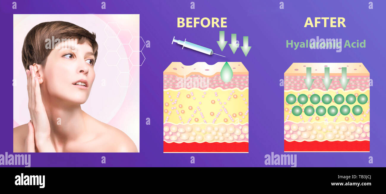 Hyaluronic acid. skin-care products. skin rejuvenation Stock Photo