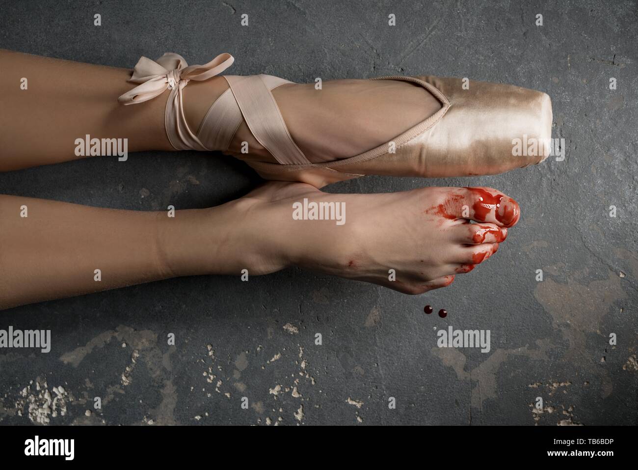 Damaged bloody legs of ballerina Stock Photo
