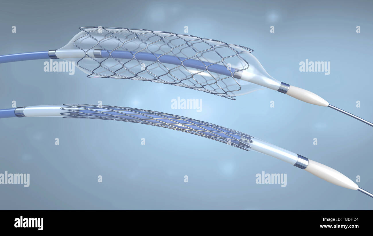 Deflated and inflated stents and balloon catheters, illustration Stock