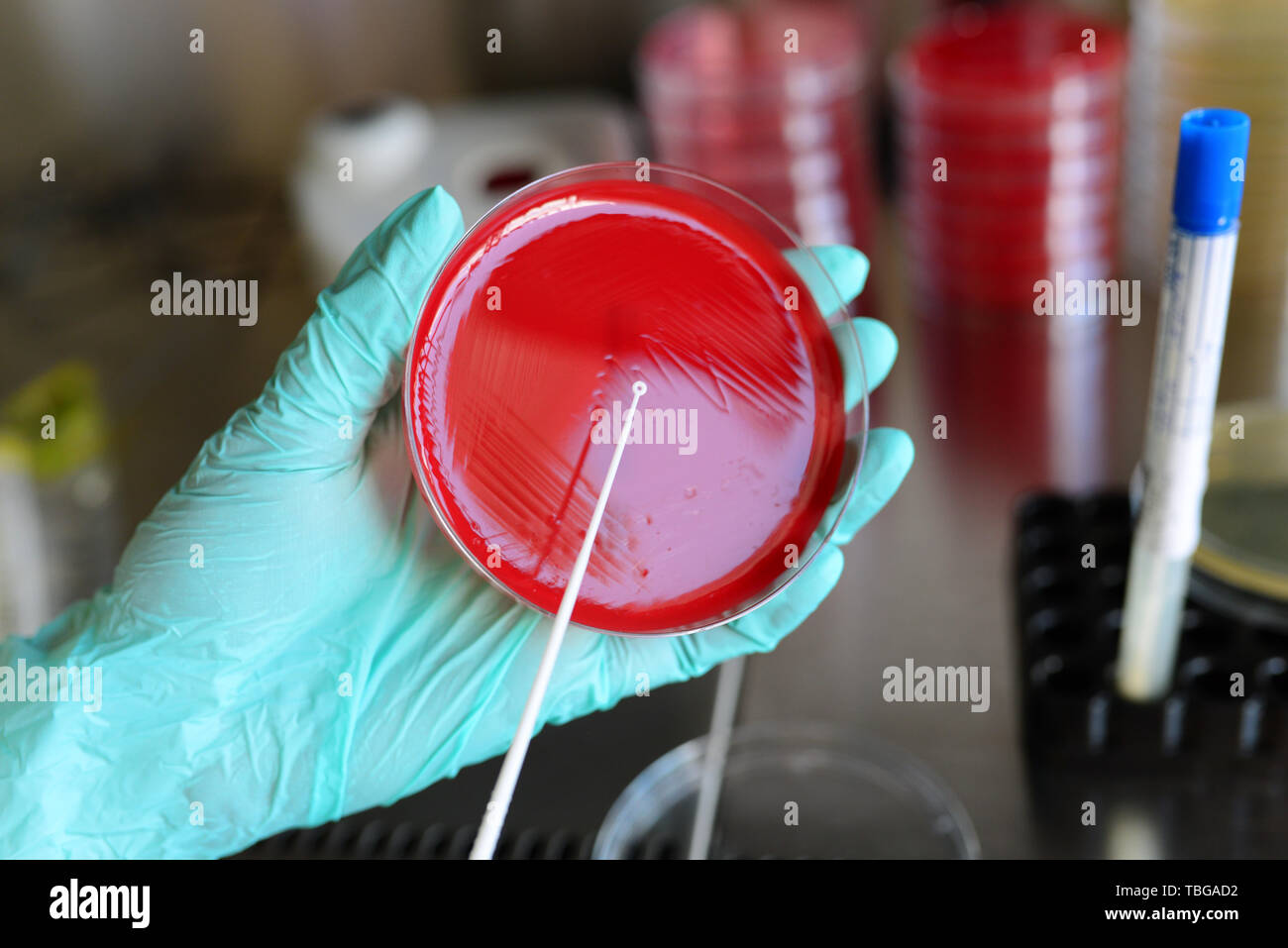 Medical clinic Pathological bacteria cultivation sample test Stock