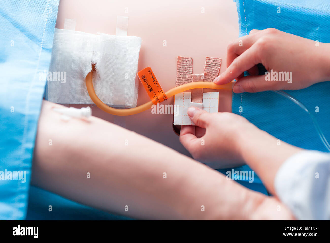 Intraperitoneal Drain