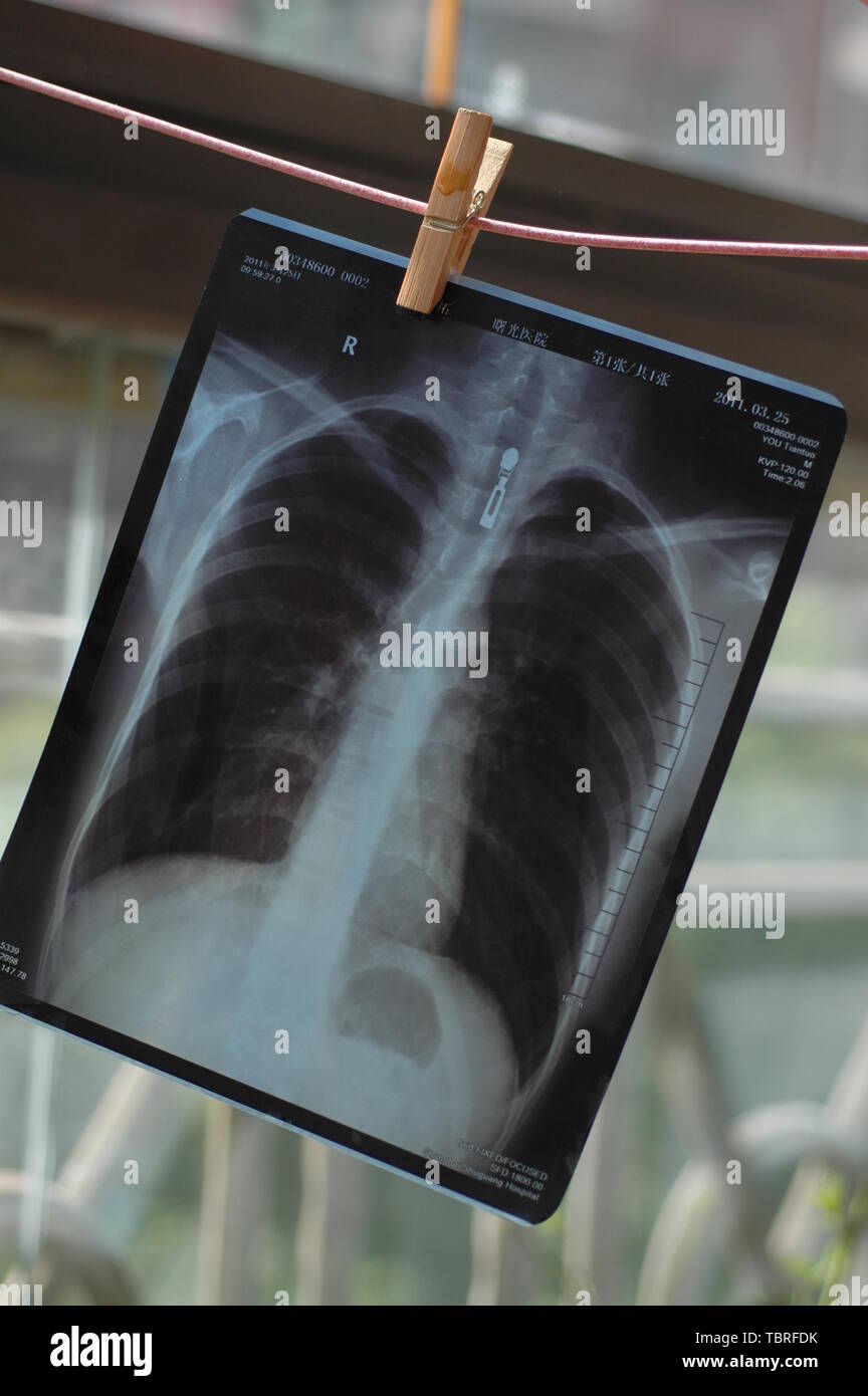 X ray perspective hi-res stock photography and images - Alamy