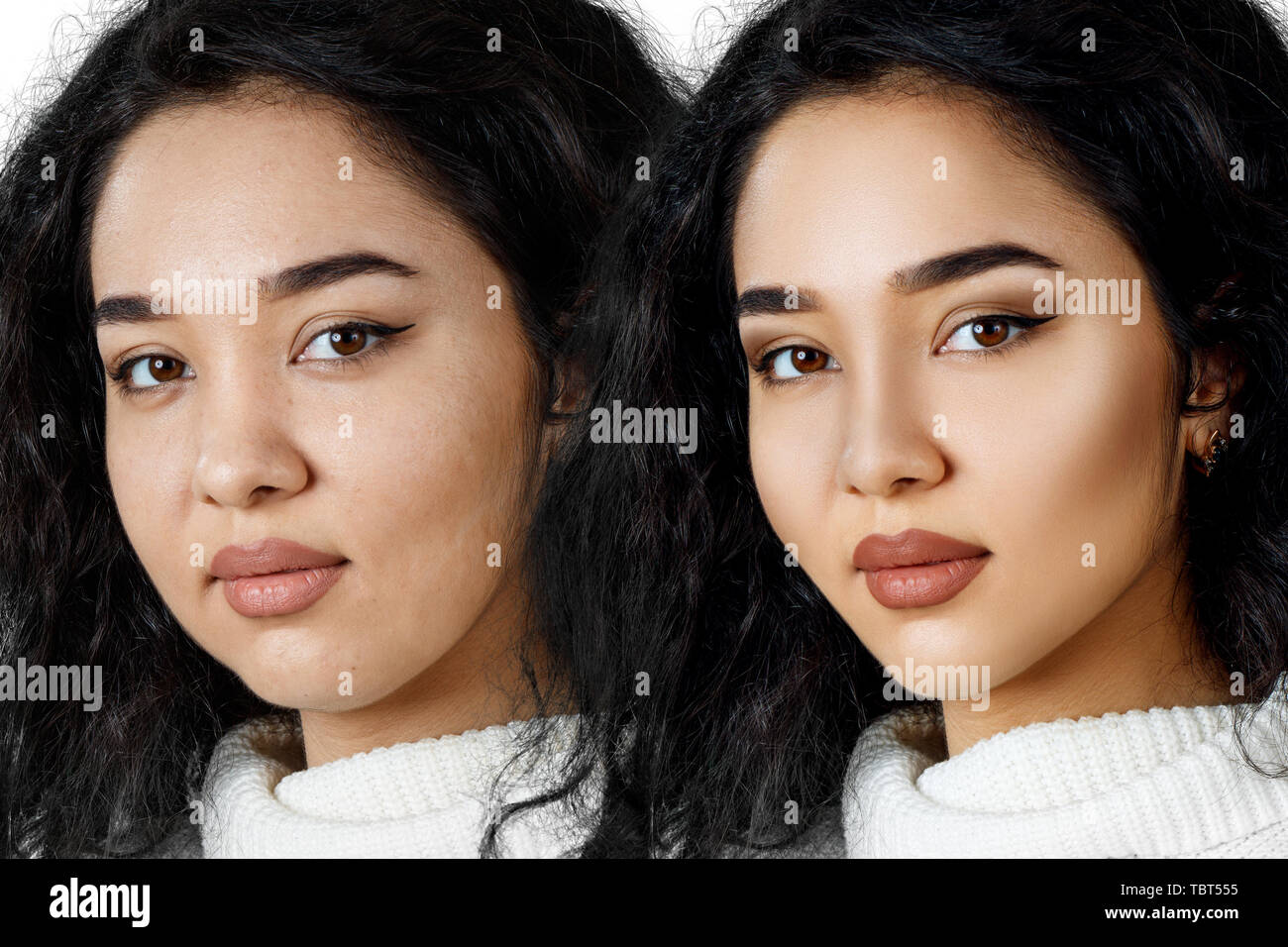 Young girl with problem skin before and after retouch. Stock Photo