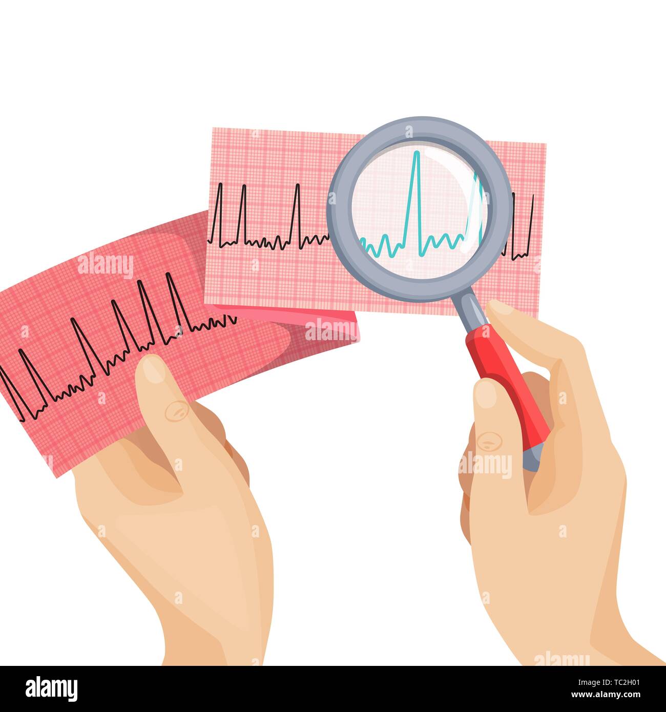 Look on atrial fibrillation through magnifying glass that human hand holds in round vector picture on white. Long piece of paper with ECG scheme of im Stock Vector