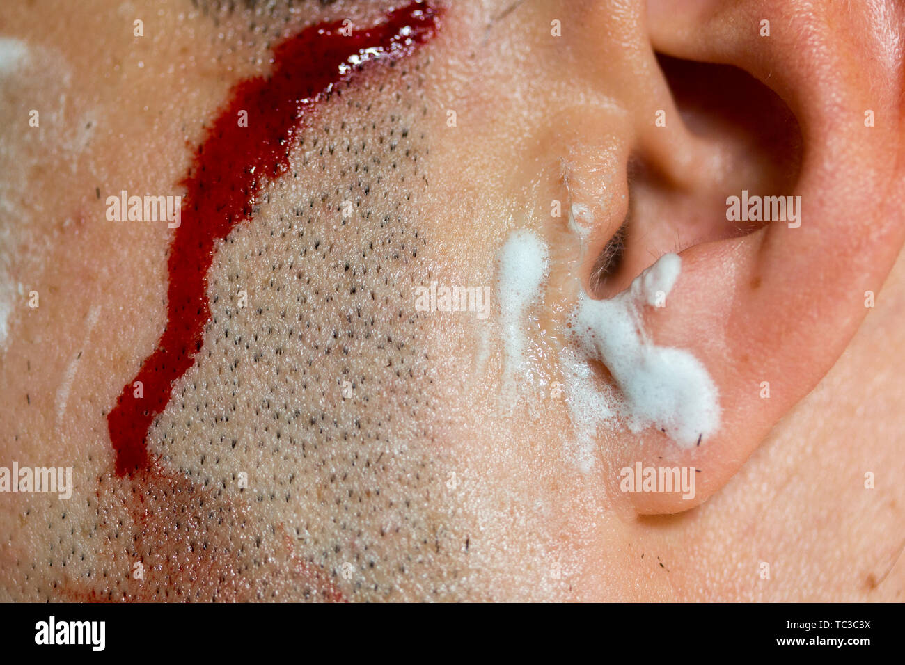 Man bleeds after shaving facial hair Stock Photo