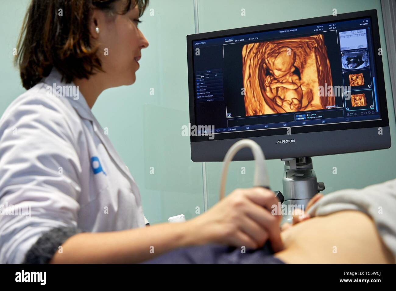 ultrasound diagnostic systems, Ultrasound 4d, Hospital, Donostia, San Sebastian, Gipuzkoa, Basque Country, Spain Stock Photo