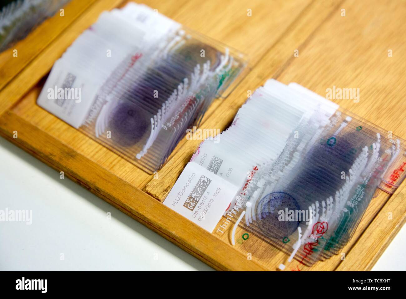 Samples, Cervical cancer screening program. The cervix is the lower part of the uterus. The cancer screening is looking for cancer before it has any Stock Photo