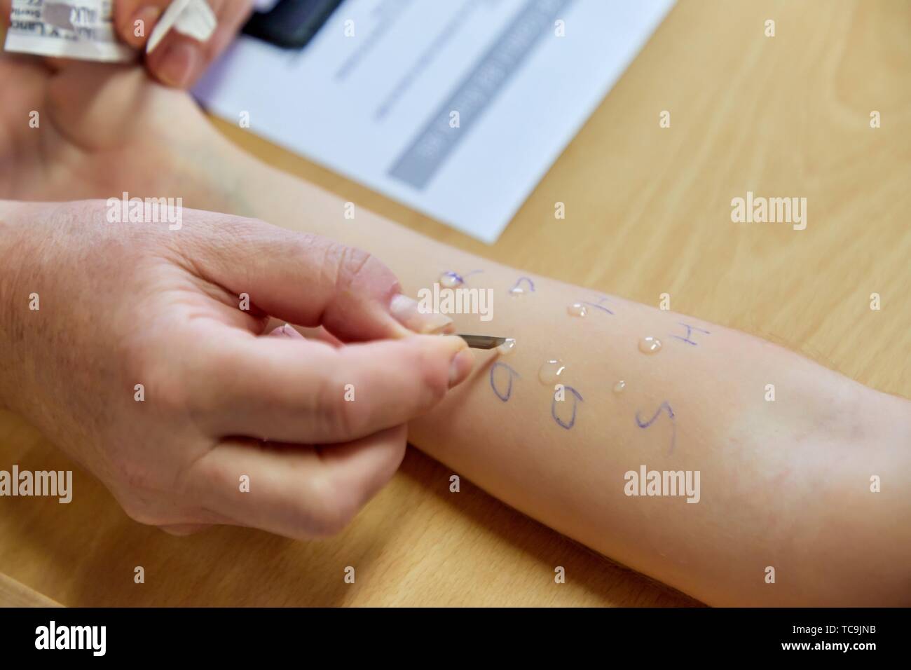 Skin test hires stock photography and images Alamy