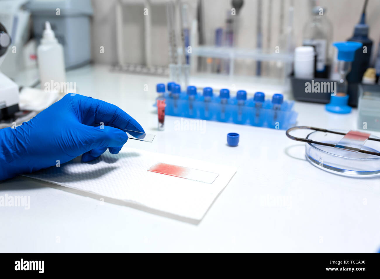 scientist prepare blood sample for research on microscope. Placing