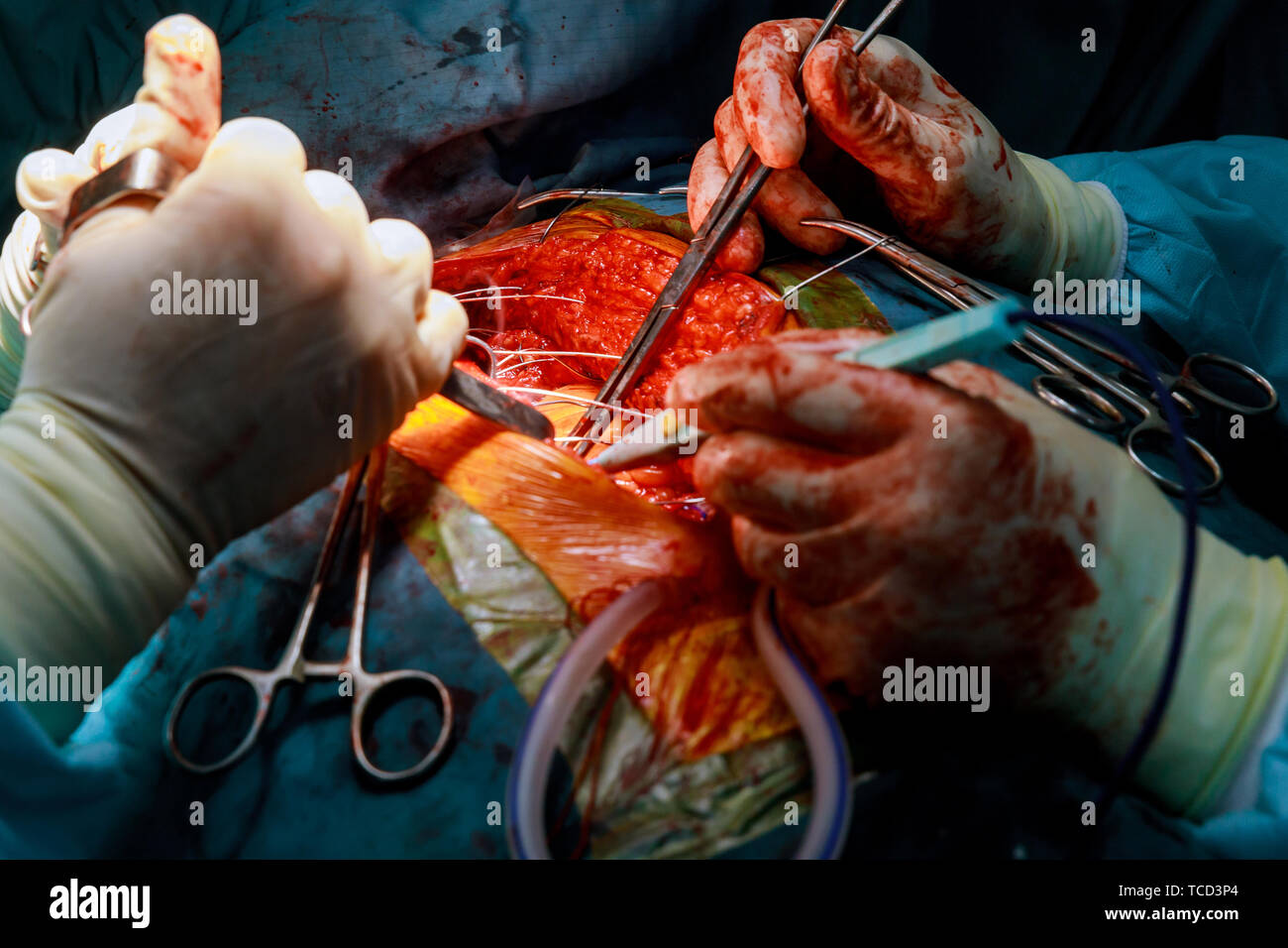 Cardiopulmonary Bypass Stock Photos & Cardiopulmonary Bypass Stock