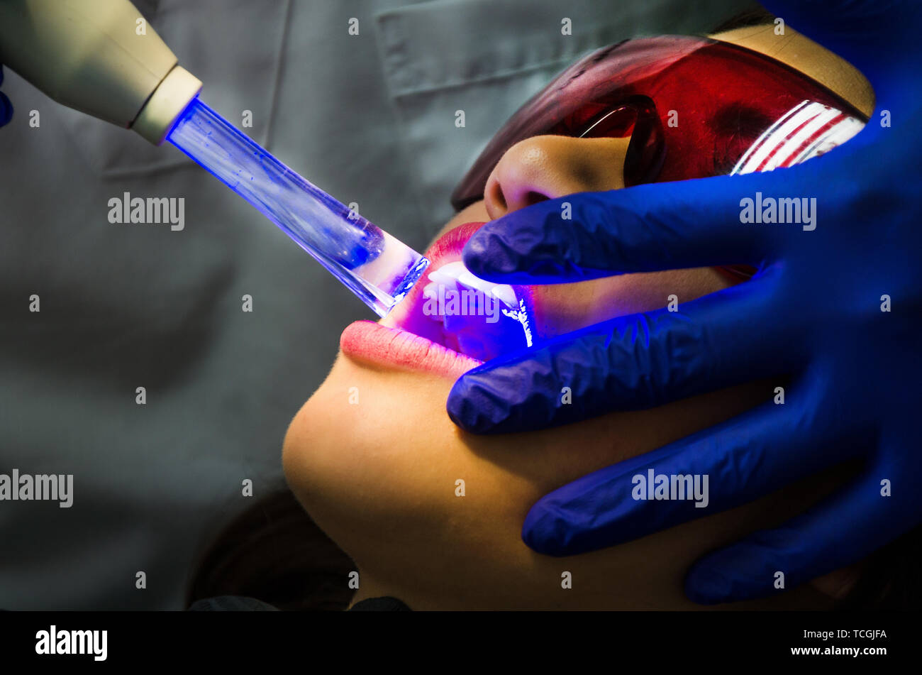 Dentist examining patient mouth in dental exam whitenening teeth with dentist's instrumentation in clinic. Stock Photo