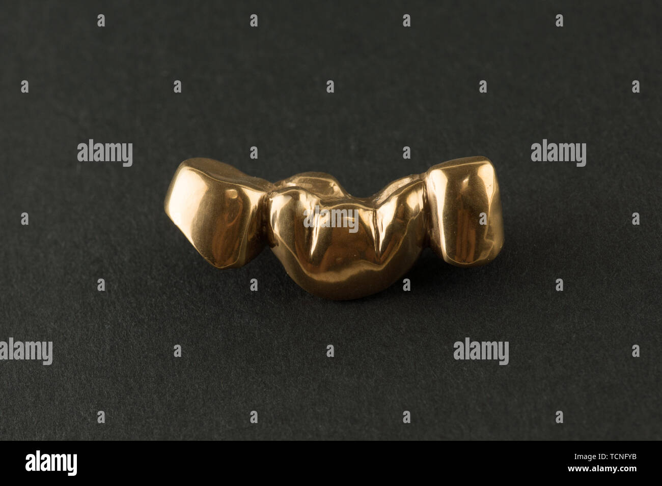 Steel artificial coated nitride titanium dental crown for dentition