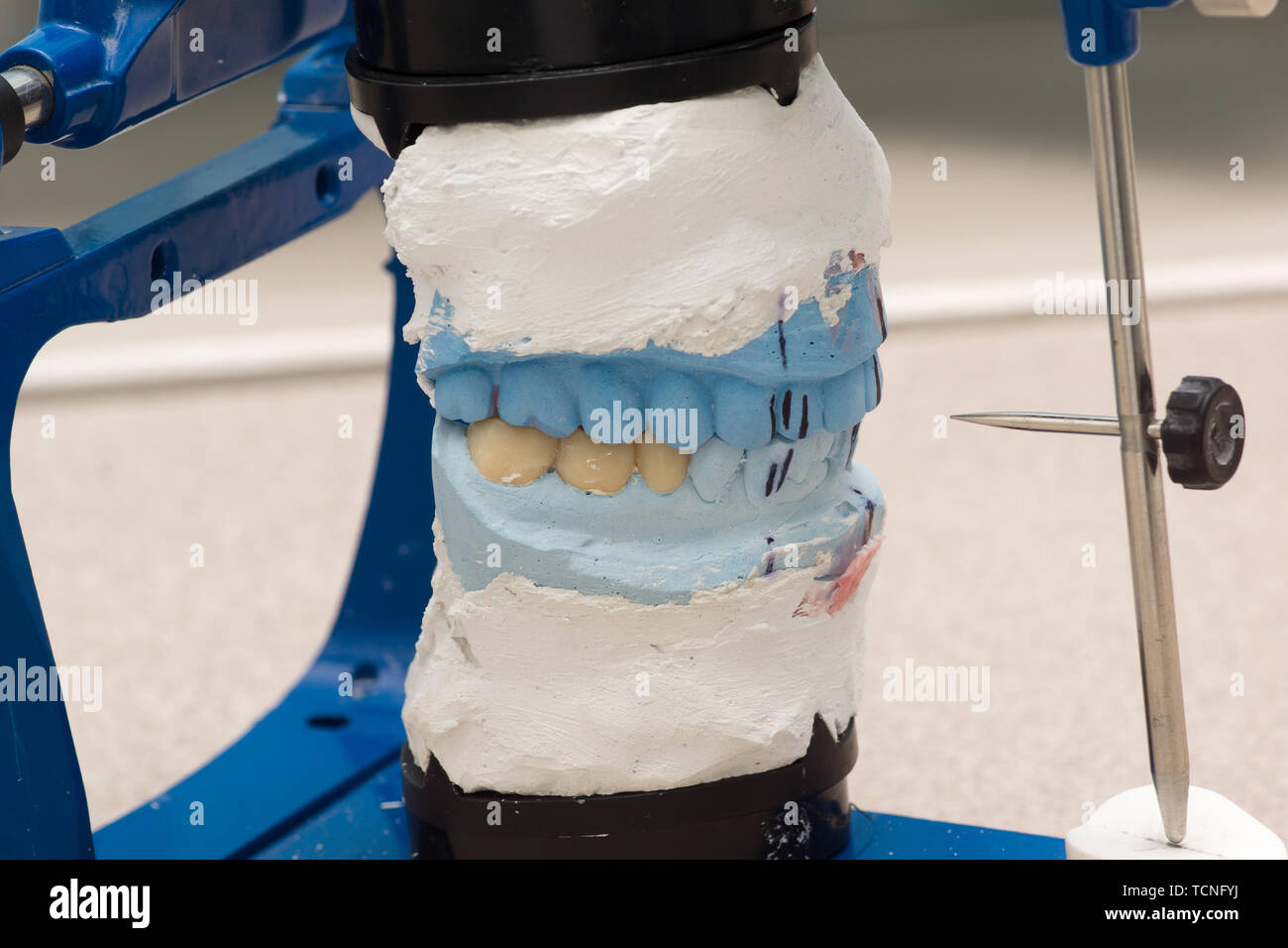 dental articulator with plastered dental bridge models Stock Photo Alamy