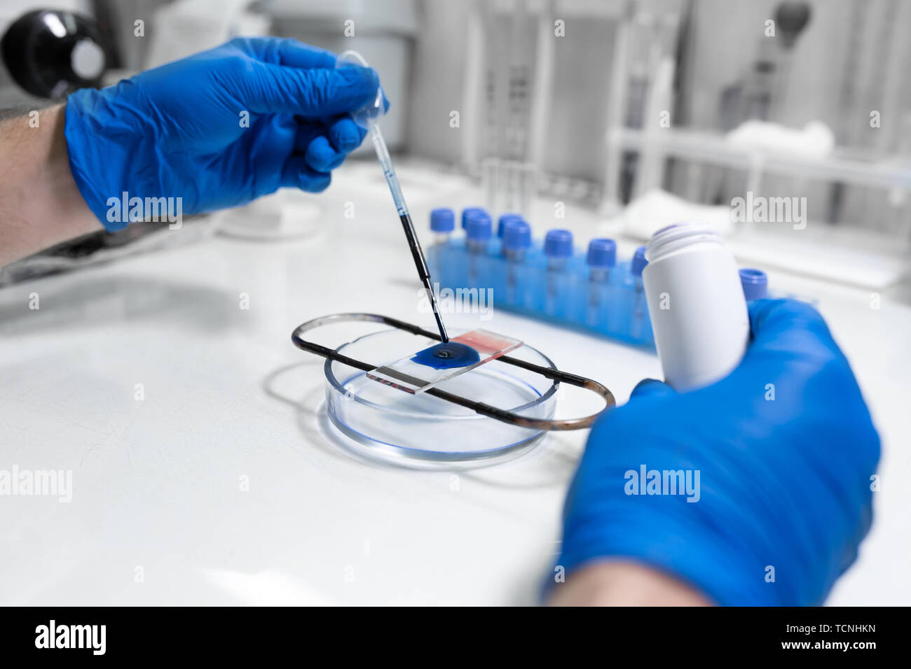 scientist prepare blood sample for research on microscope. Placing
