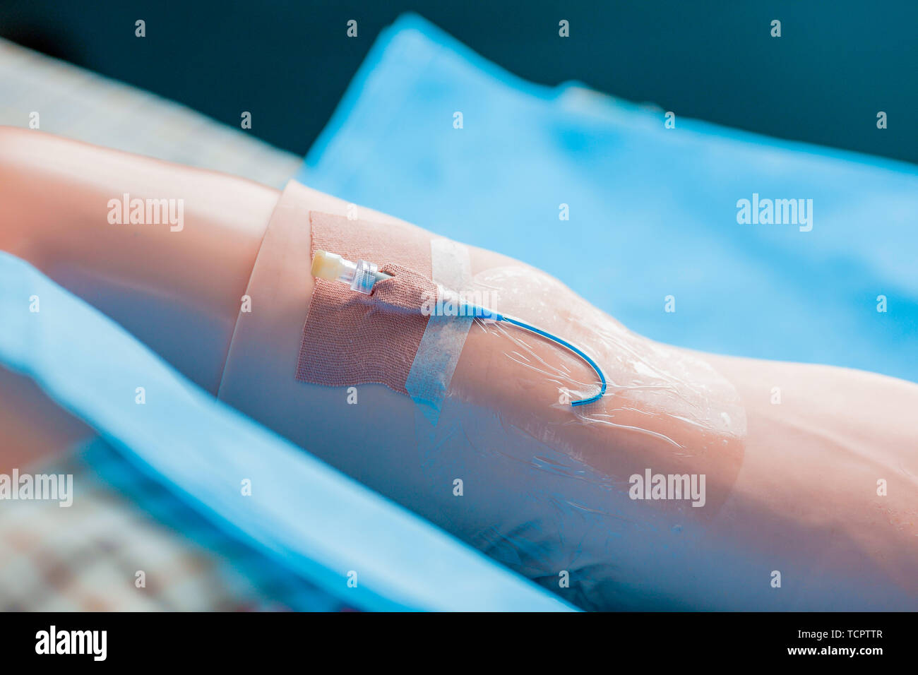 Medical nursing operation intravenous infusion needle, gastric tube