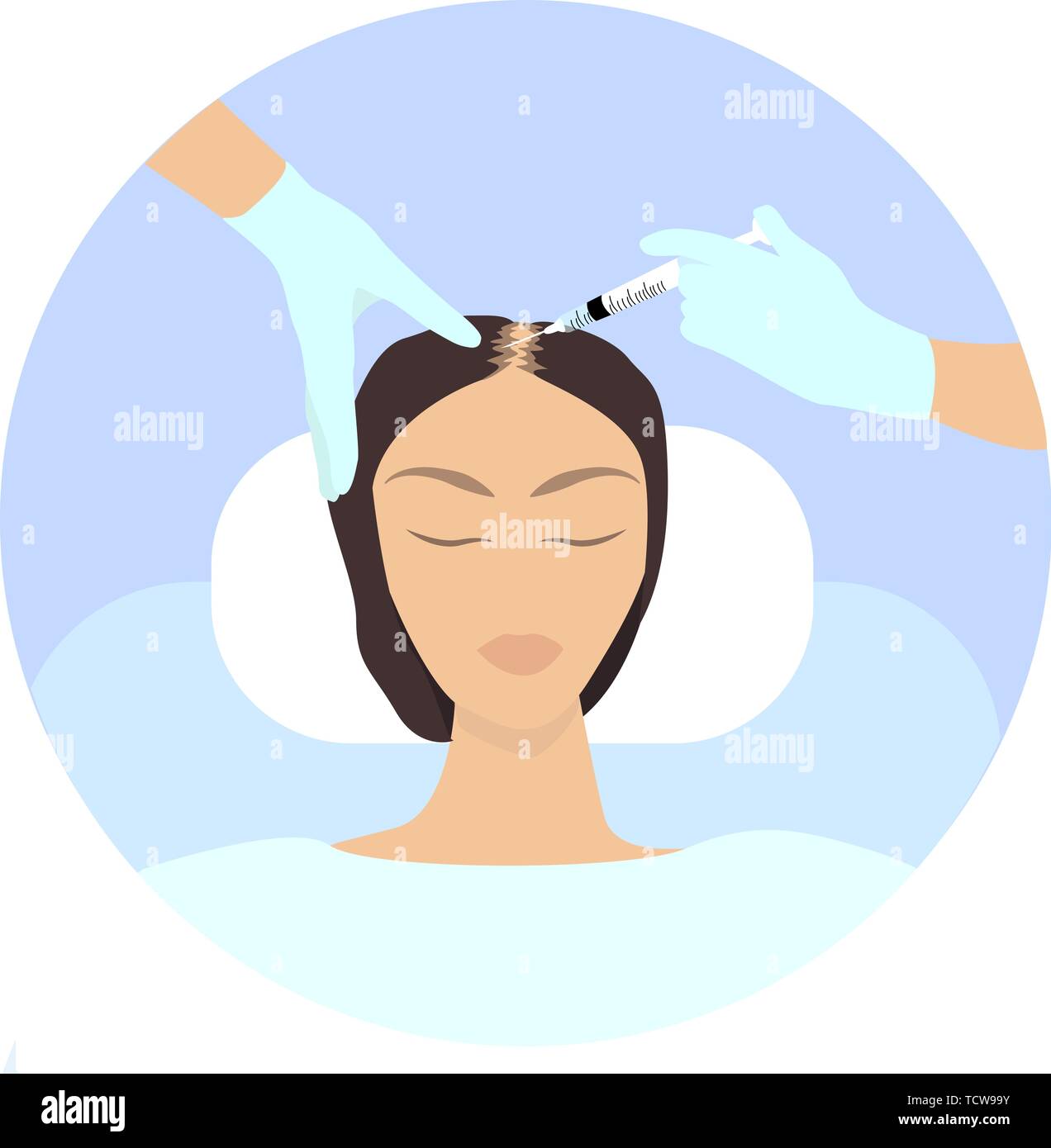 Female baldness treatment infographics. Meso therapy and hair growth stimulation. Vector illustration. - Vector illustration Stock Vector