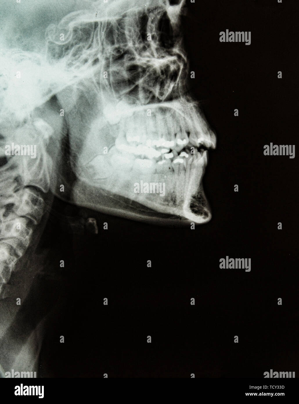 X ray anatomy hi-res stock photography and images - Alamy