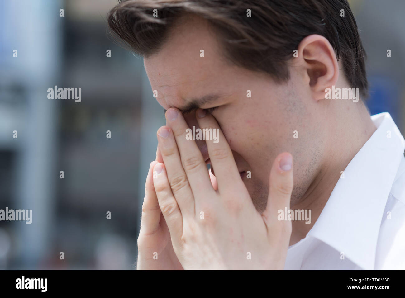 A young man has Itchy, watery, swollen eyes due to pollen allergy Stock