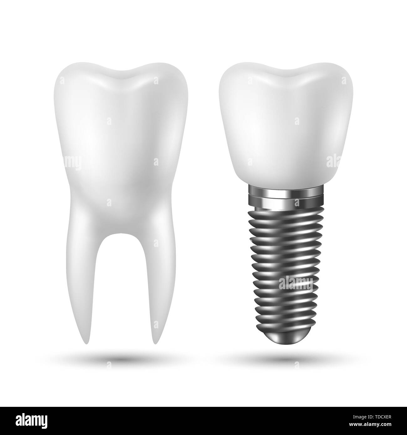 Vector 3d Realistic Render White Tooth Implant Denture Icon Set Closeup ...