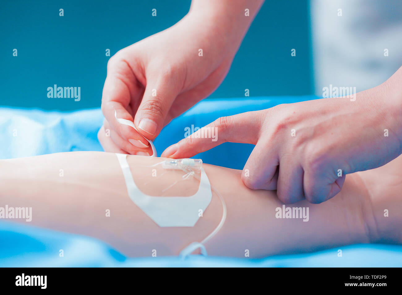 Medical nursing operation intravenous infusion needle, gastric tube