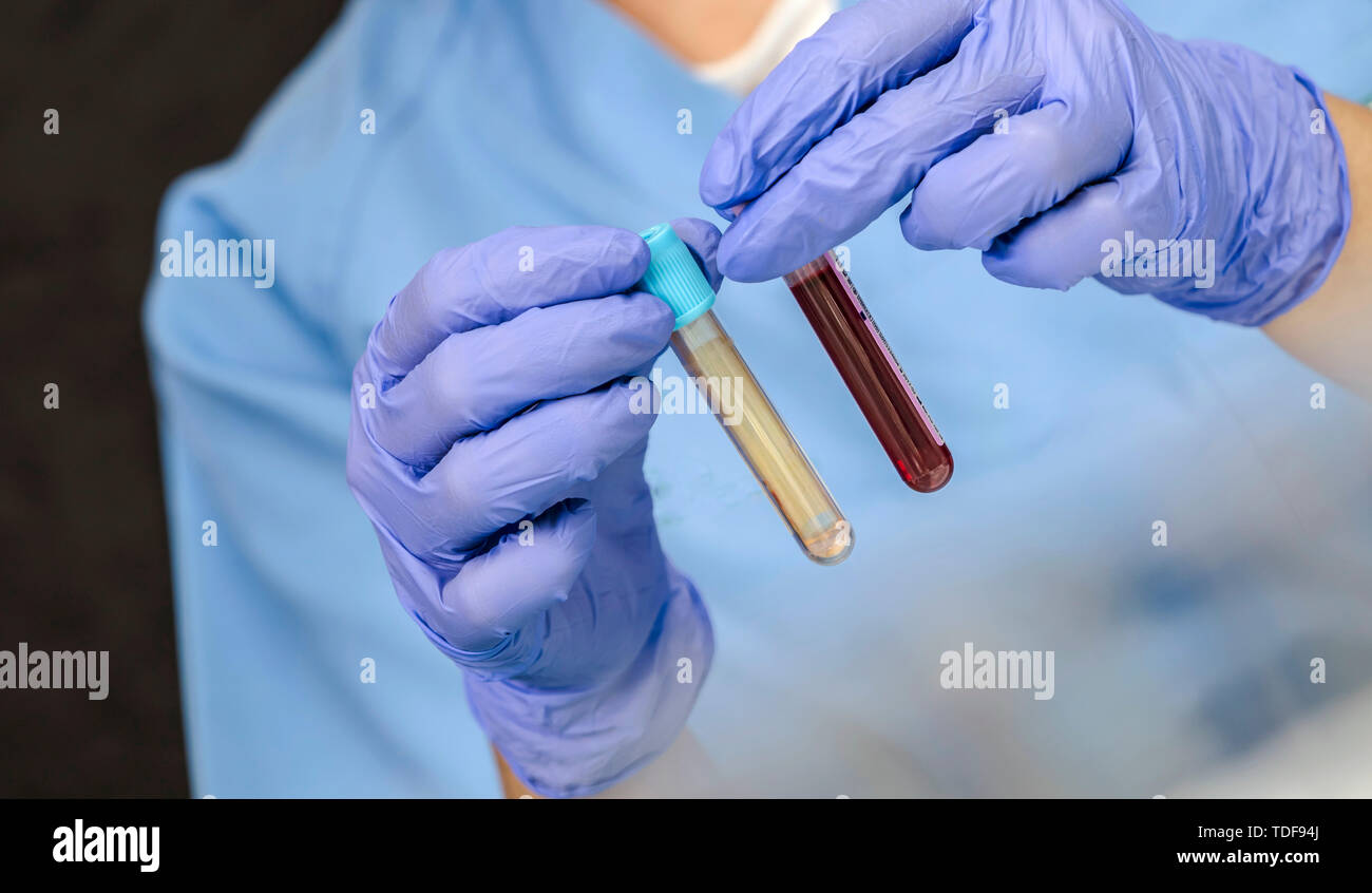 Nurse compares two vials of blood sample in a hospital, conceptual
