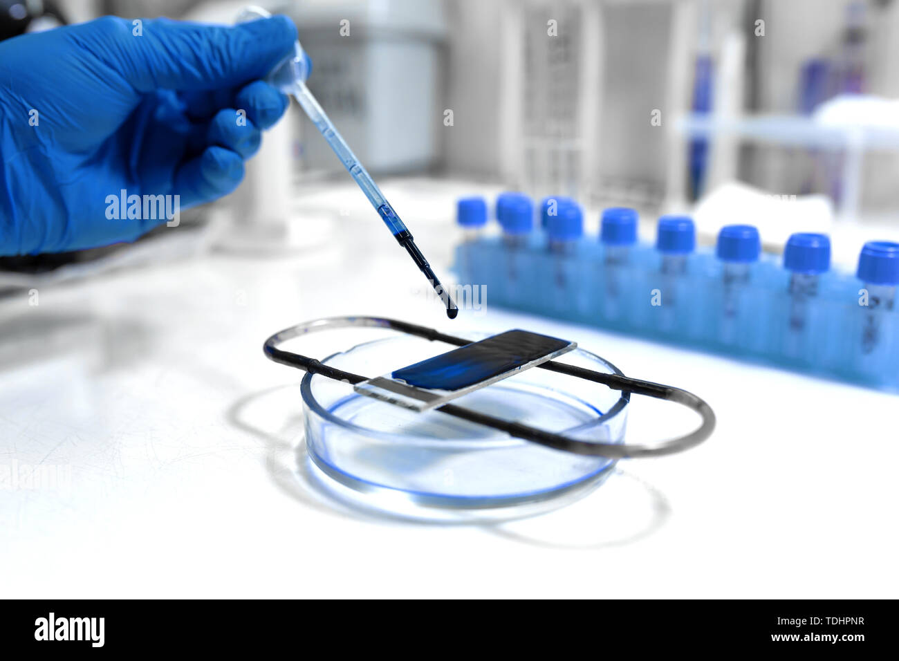 scientist prepare blood sample for research on microscope. Placing