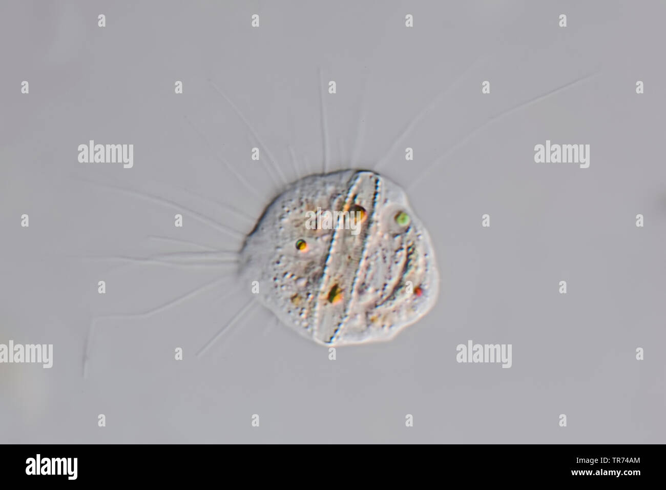 amebas, amoebas (Amoebozoa), living amoeba from Tessin, Differential interference contrast microscopy, x 160, Switzerland, Ticino Stock Photo