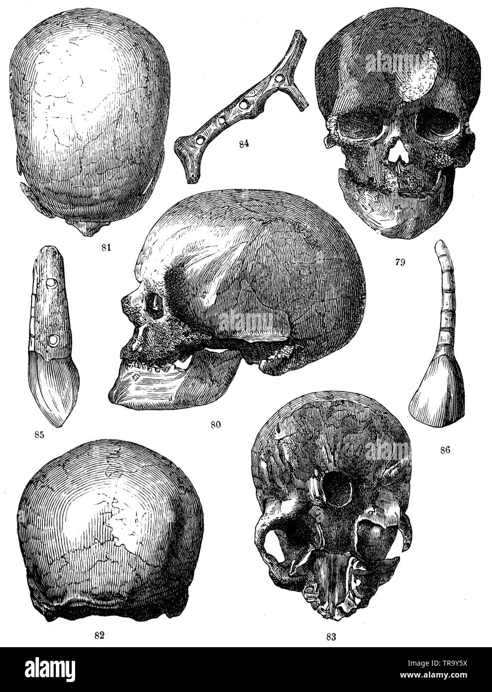 79-83) Skull of an old man from the Cro-Magnon cave. 79) Face. 80) Profile. 81) Seen from above. 82) Seen from behind. 83) Base. 84) Carved handle of a reindeer horn instrument. 85) Tooth of a fox, transverse view. 86) Front view., ,  (anthropology book, 1874) Stock Photo