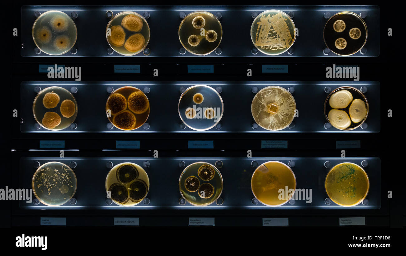 different samples with kinds of bacterias living at common household