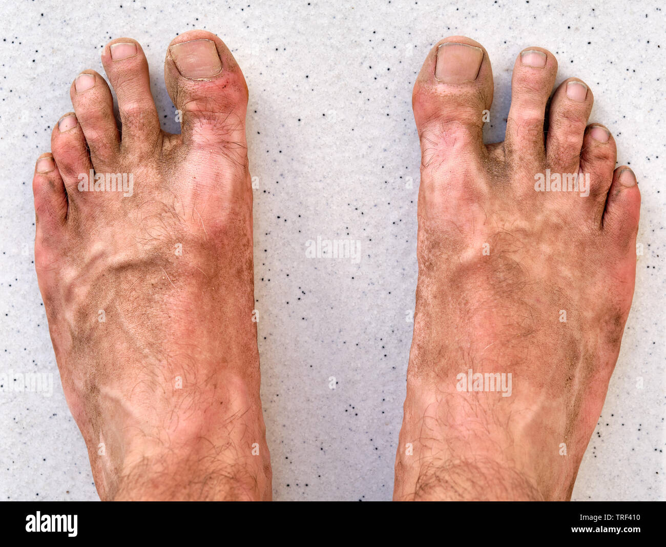 Dirty toes hi-res stock photography and images - Alamy