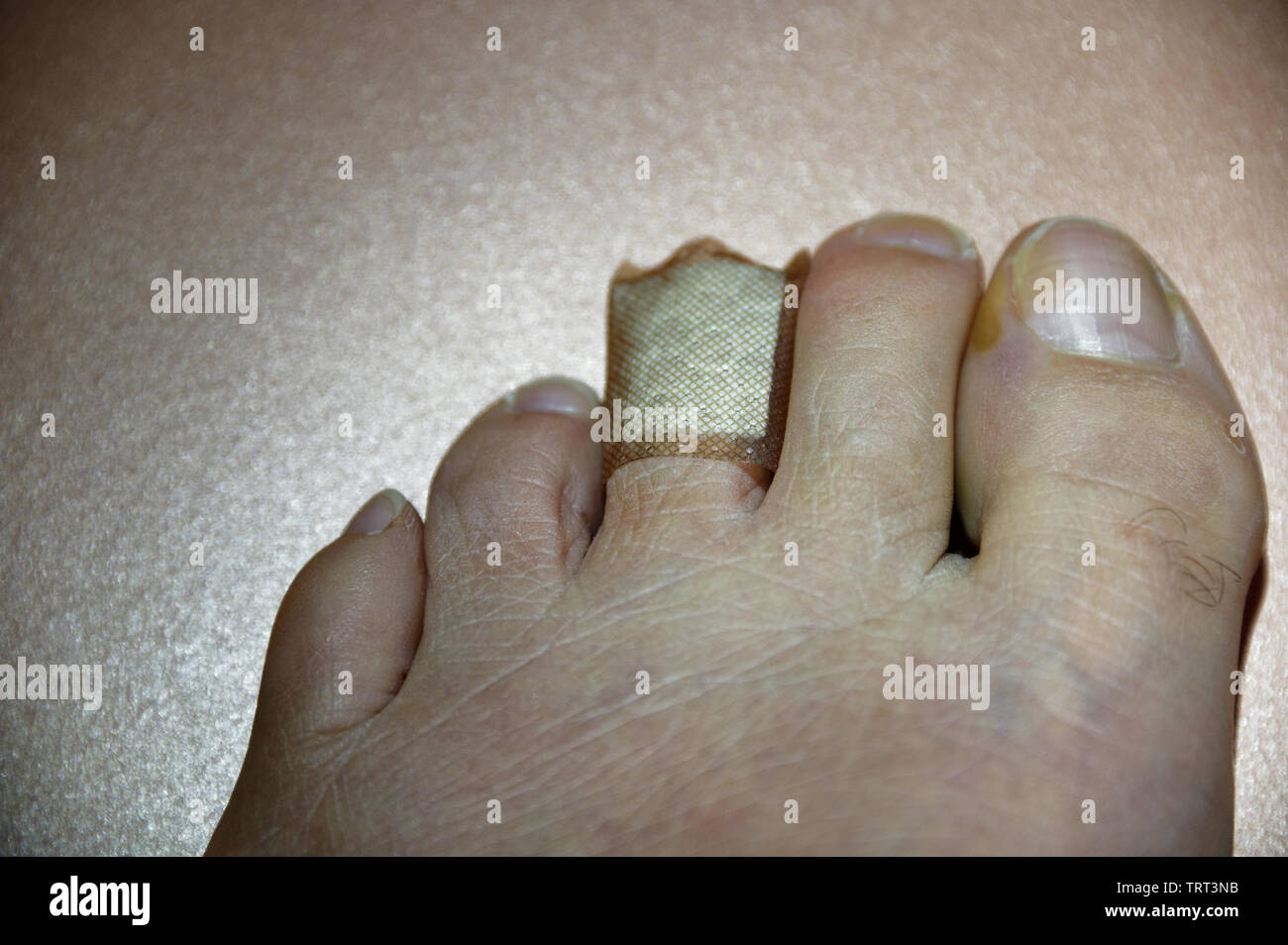 An injured toe is protected by a piece of sticking plaster Stock Photo