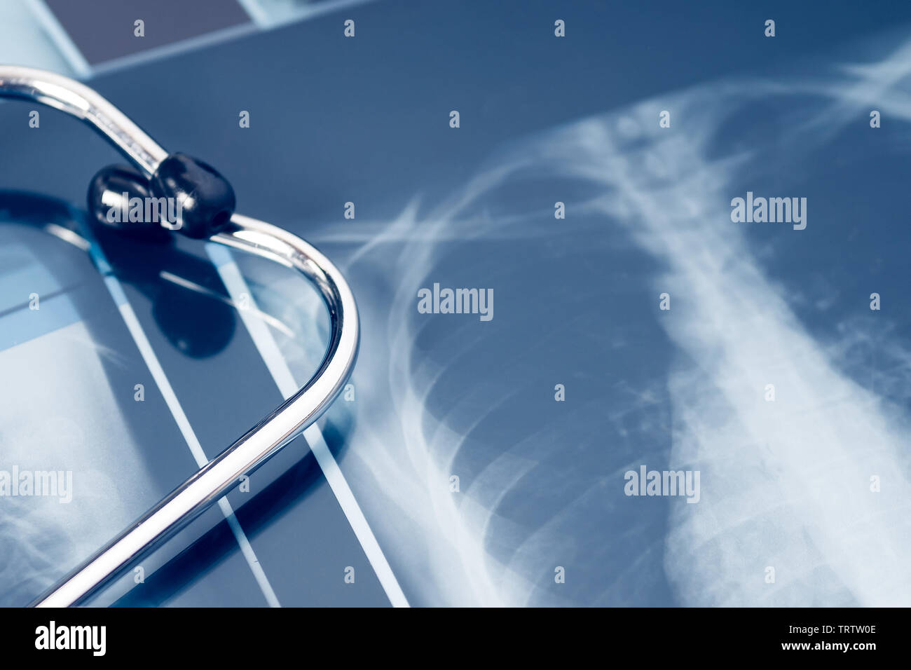 xray of the lungs with stethoscope. concept lung disease Stock Photo