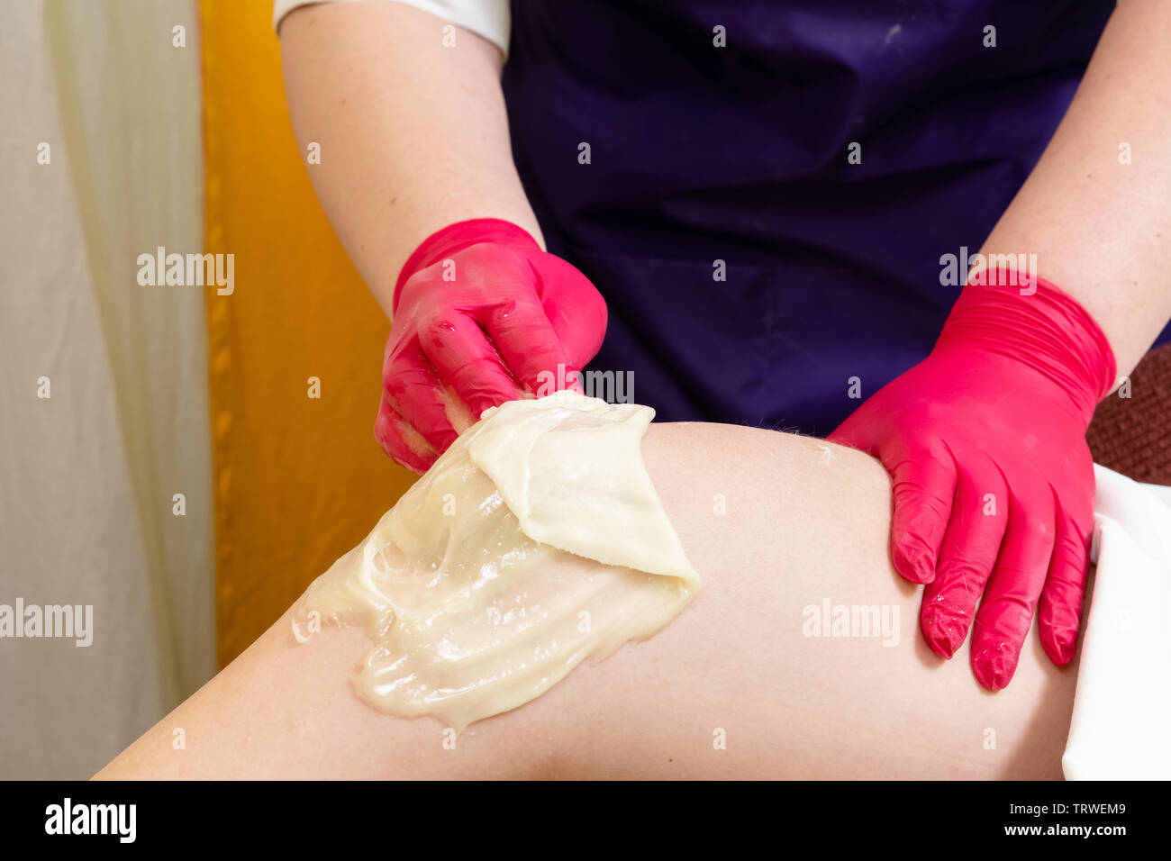 Method of hair removal sugar paste for sweetening c female body. The work and methods of the master are shown. Stock Photo