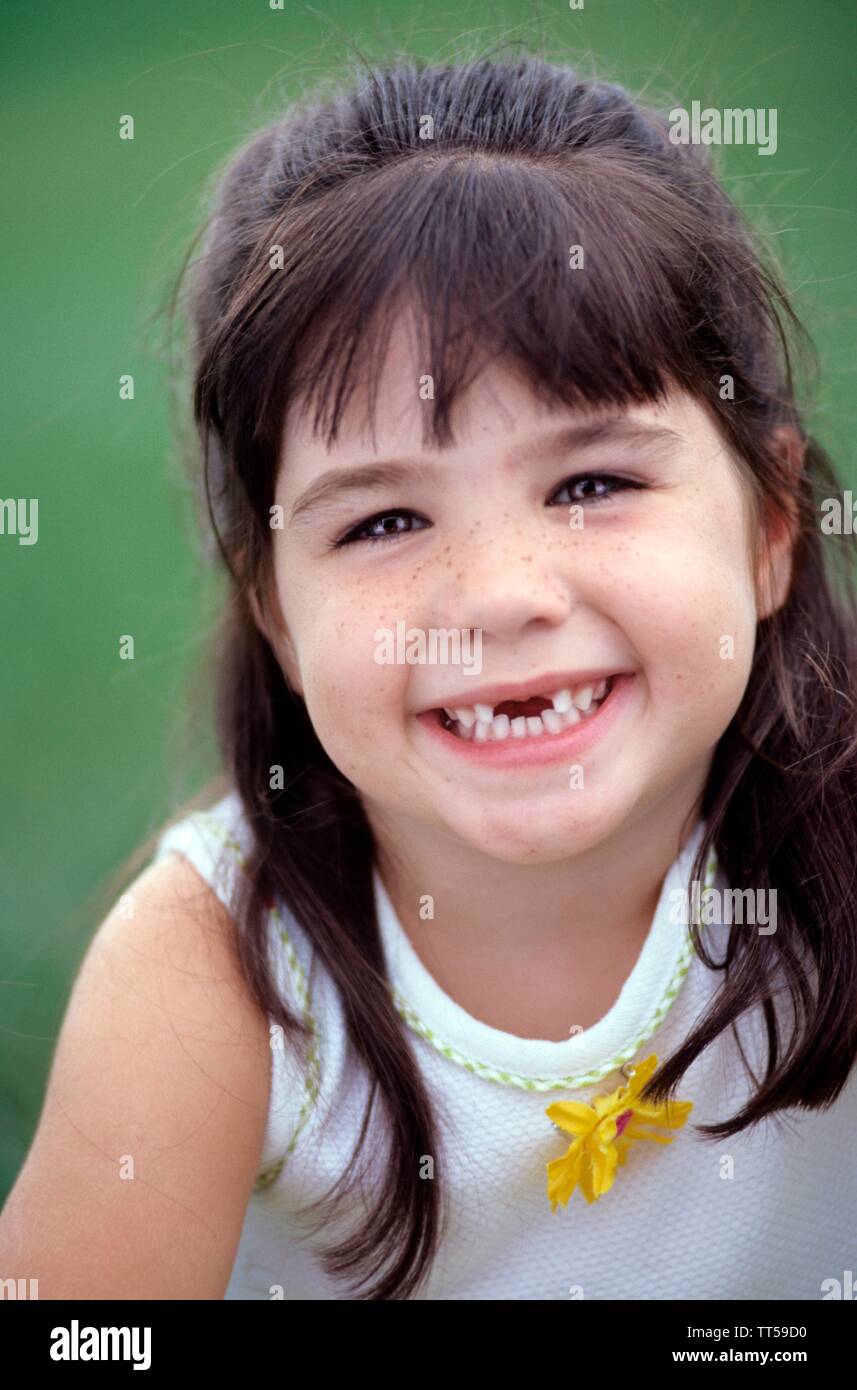 Young girl with brown hair smile missing her two front teeth Stock Photo