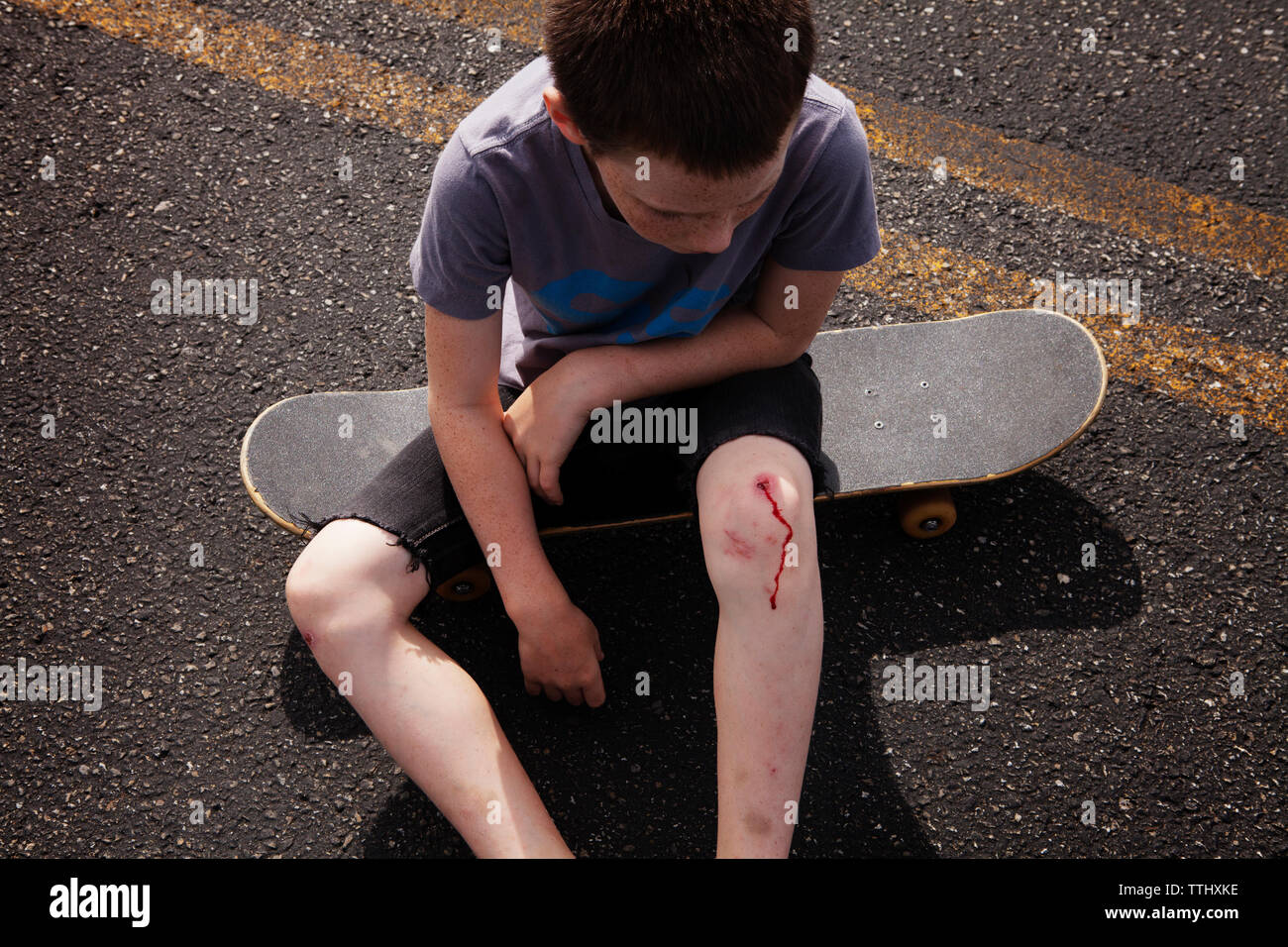 Skateboard injury hires stock photography and images Alamy