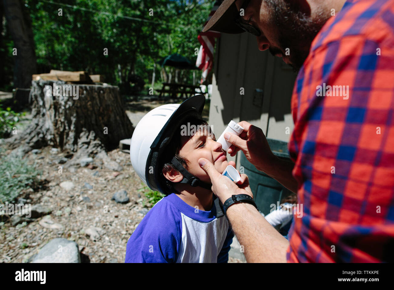 Father applying medicine on son's nose at Inyo National Forest Stock Photo