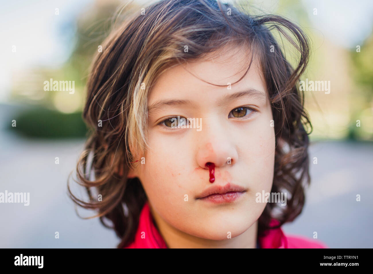 A boy looks directly at the camera with a nosebleed Stock Photo