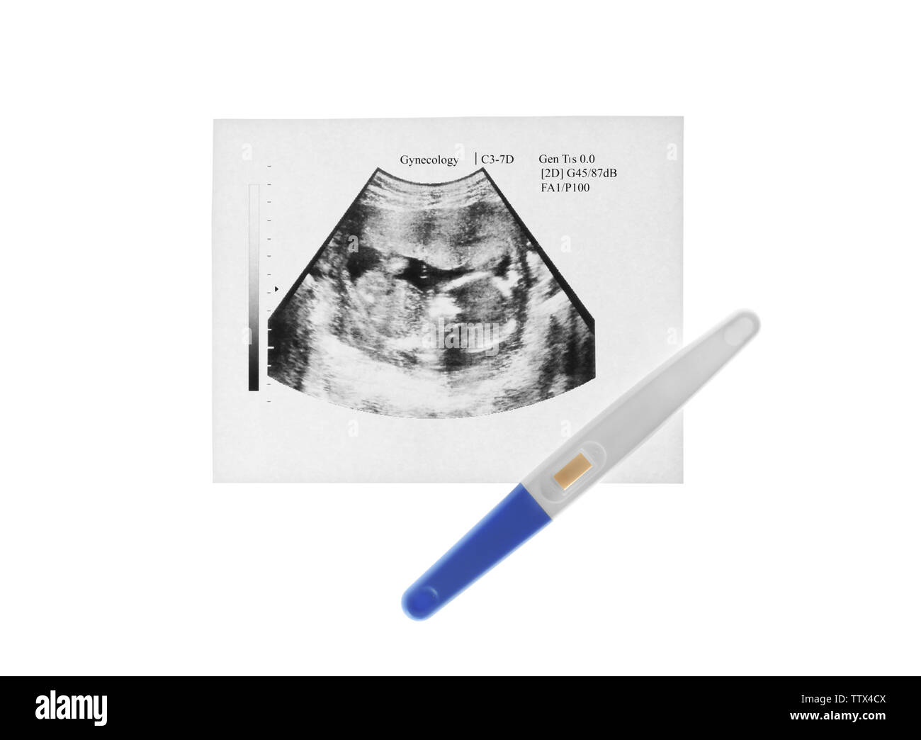 Ultrasound for pregnancy near me