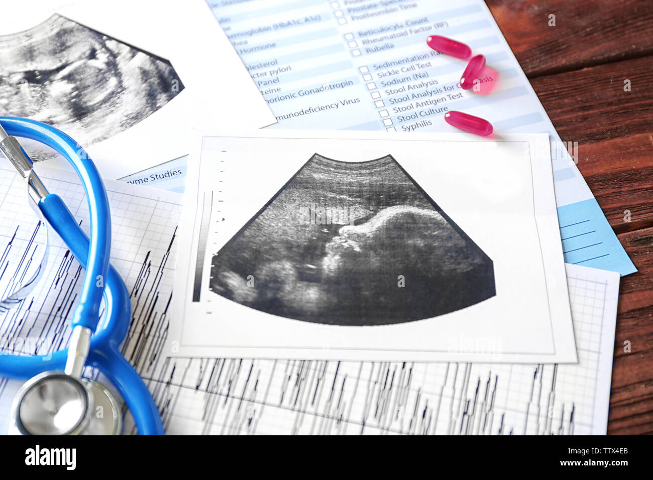Ultrasound scan of baby and stethoscope, closeup Stock Photo Alamy