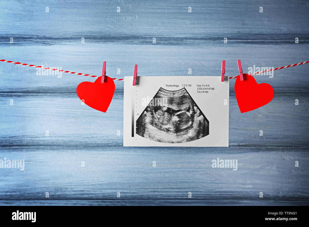 Ultrasound of baby hanging on rope Stock Photo - Alamy