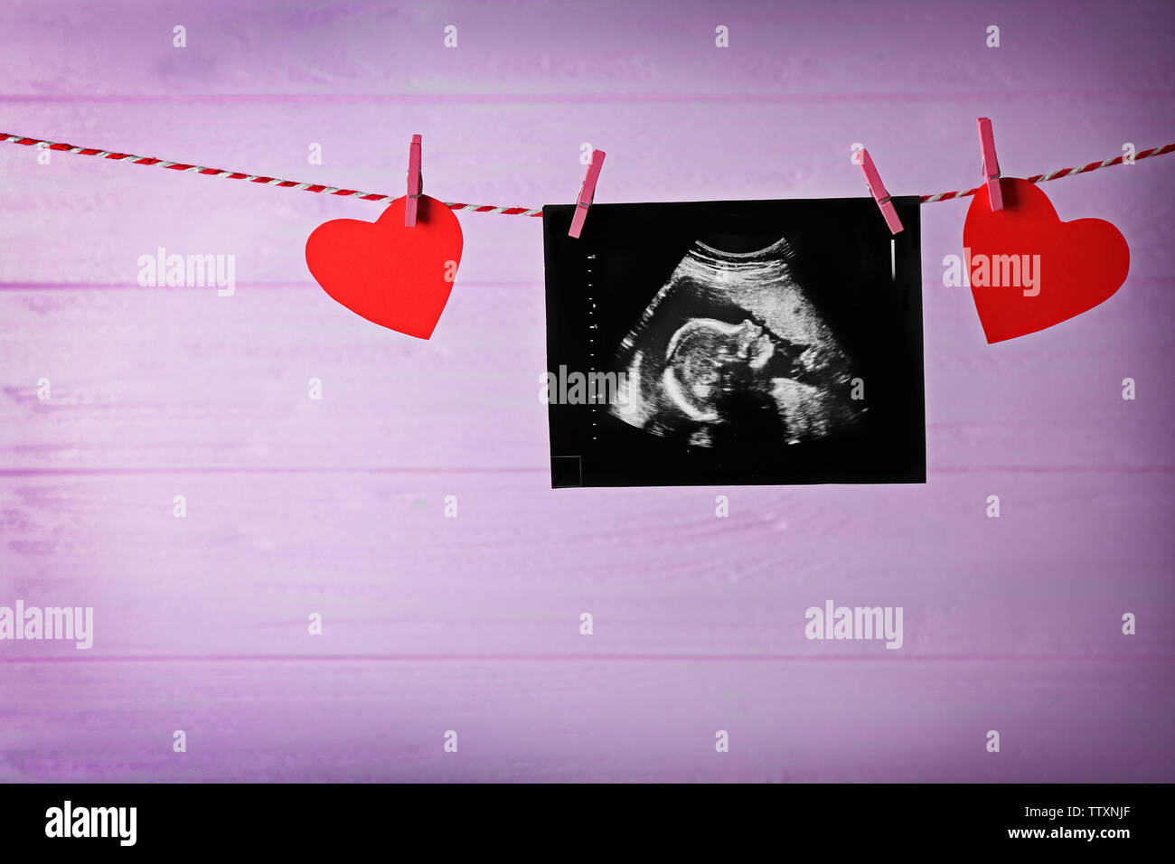 Ultrasound of baby hanging on rope Stock Photo - Alamy