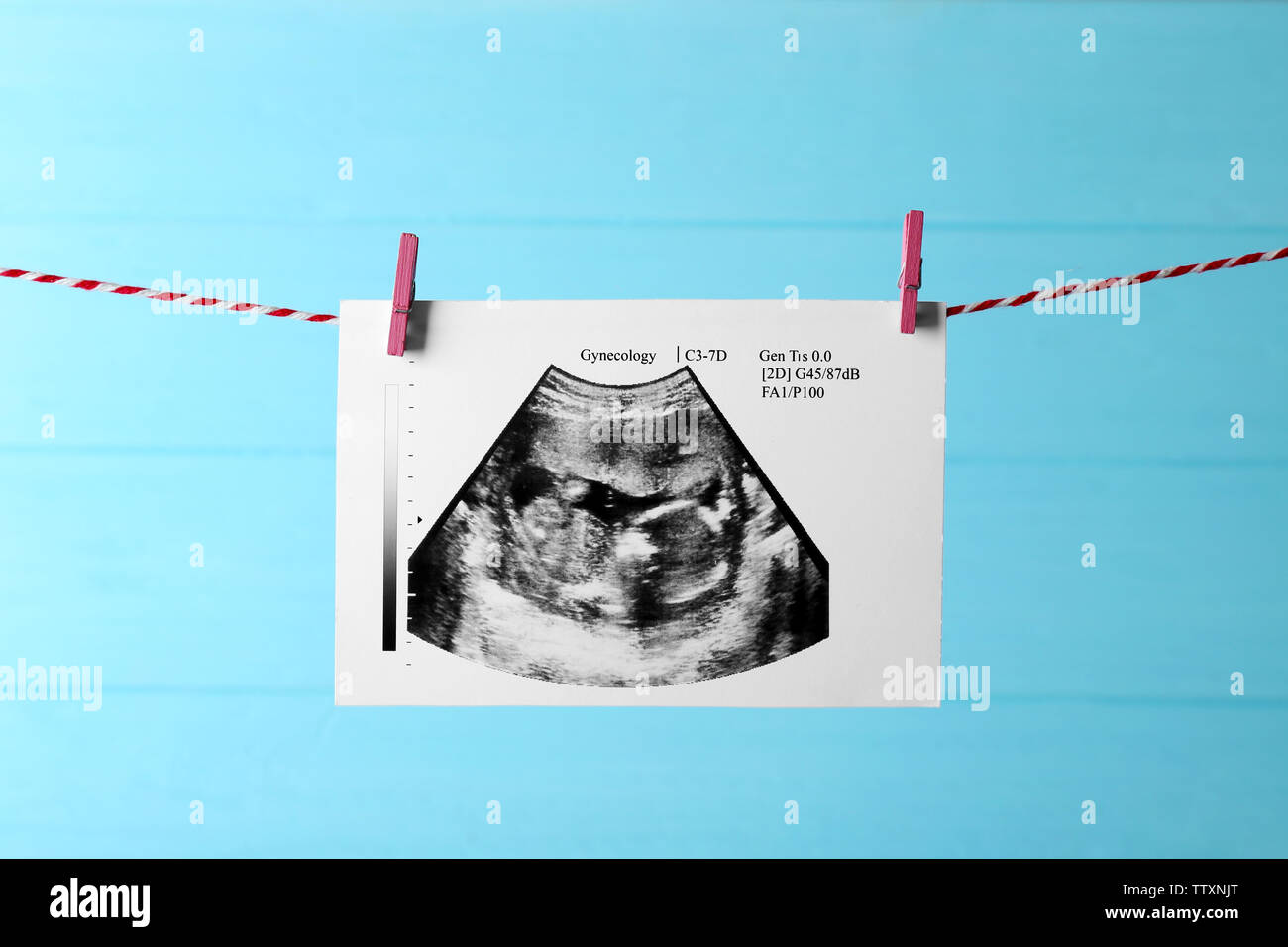 Ultrasound of baby hanging on rope Stock Photo - Alamy