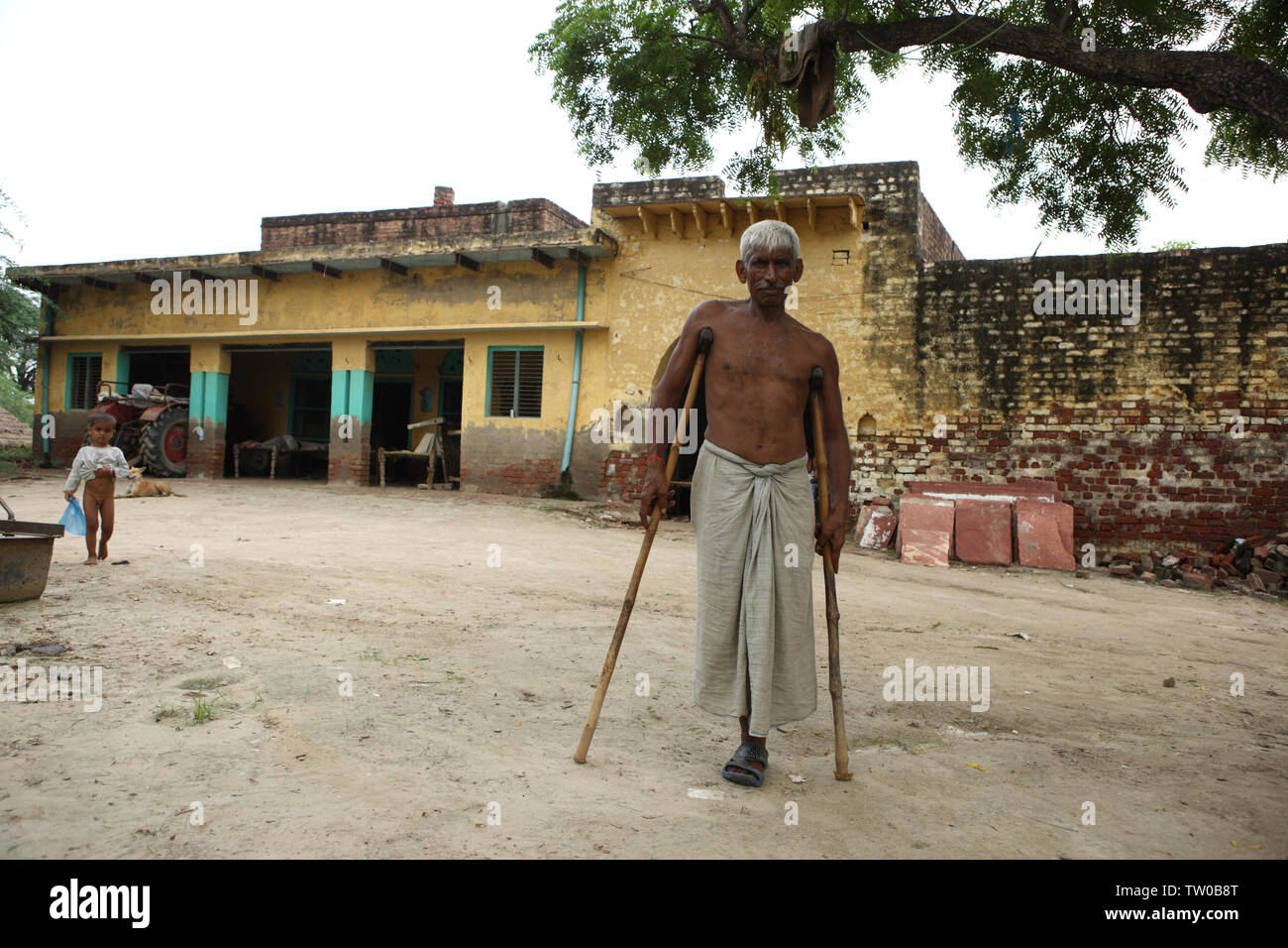 Man standing with crutch, India Stock Photo Alamy