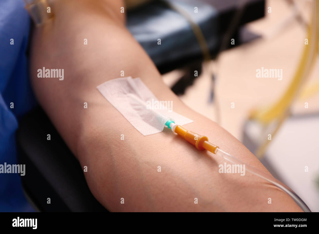 Male arm with infusion drip, closeup Stock Photo Alamy