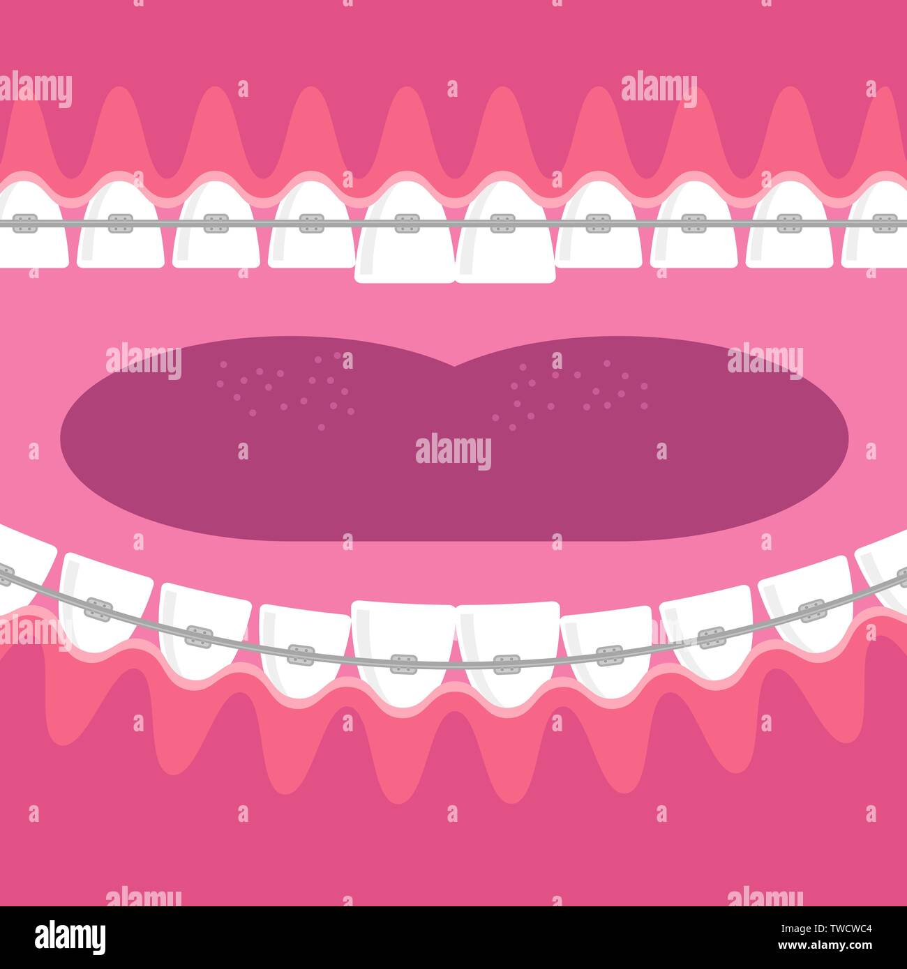 Braces Teeth. Dental Care Background. Orthodontic Treatment. Cartoon